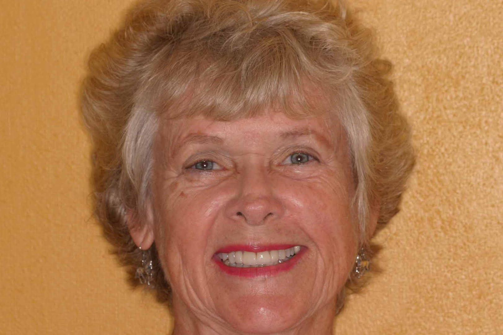 Cosmetic Dentist Fort Myers Cape Coral Naples FL